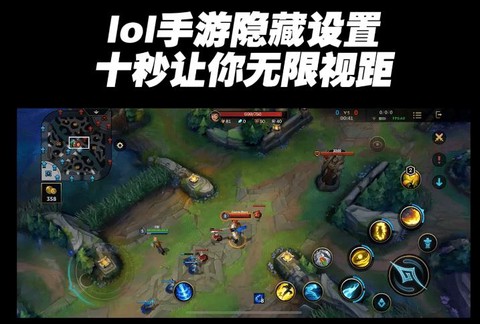 英雄联盟视距怎么调